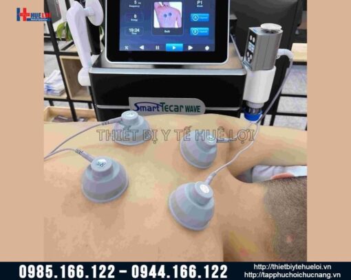 Máy xung kích kết hợp tần số vô tuyến và điện xung K-Smart Wave
