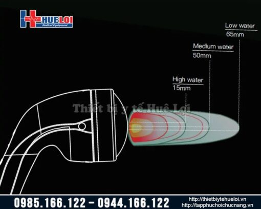 Máy xung kích hội tụ EMFocus- ElectroMagnetic Shockwave