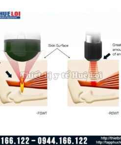 Máy xung kích hội tụ EMFocus- ElectroMagnetic Shockwave