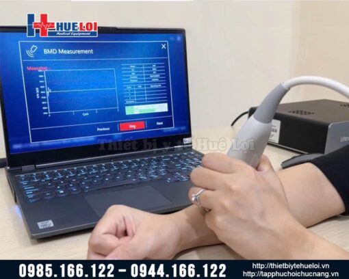 Máy đo mật độ canxi BMD-A1