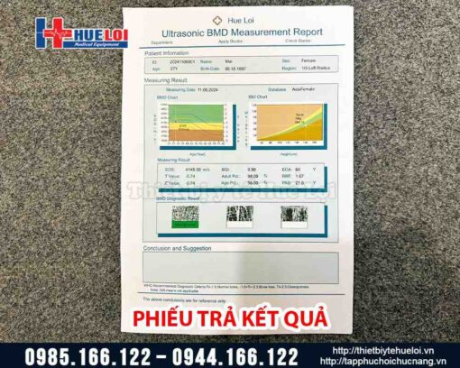 Máy đo mật độ canxi BMD-A1